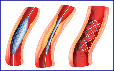 Cardiologia